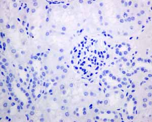 Immunohistochemistry (Formalin/PFA-fixed paraffin-embedded sections) - Anti-Melanoma gp100 antibody [EPR4864] (ab137062), expandable thumbnail