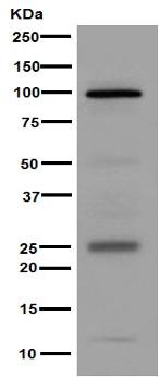 Western blot - Anti-Melanoma gp100 antibody [EPR4864] (AB137062), expandable thumbnail