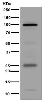 Western blot - Anti-Melanoma gp100 antibody [EPR4864] (AB137062)