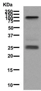 Western blot - Anti-Melanoma gp100 antibody [EPR4864] (AB137062)