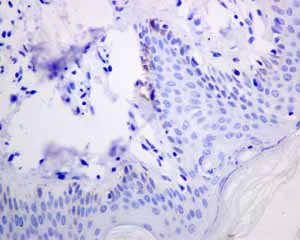 Immunohistochemistry (Formalin/PFA-fixed paraffin-embedded sections) - Anti-Melanoma gp100 antibody [EPR4864] - BSA and Azide free (AB190913)