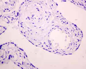 Immunohistochemistry (Formalin/PFA-fixed paraffin-embedded sections) - Anti-Melanoma gp100 antibody [EPR4864] - BSA and Azide free (AB190913)