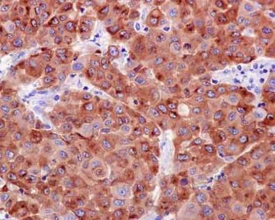 Immunohistochemistry (Formalin/PFA-fixed paraffin-embedded sections) - Anti-Melanoma gp100 antibody [EPR4864] - BSA and Azide free (AB190913)
