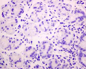 Immunohistochemistry (Formalin/PFA-fixed paraffin-embedded sections) - Anti-Melanoma gp100 antibody [EPR4864] - BSA and Azide free (AB190913)
