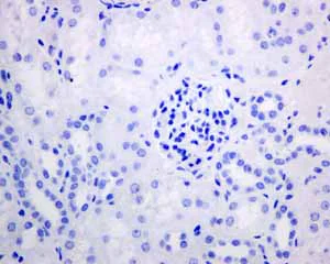 Immunohistochemistry (Formalin/PFA-fixed paraffin-embedded sections) - Anti-Melanoma gp100 antibody [EPR4864] - BSA and Azide free (AB190913)