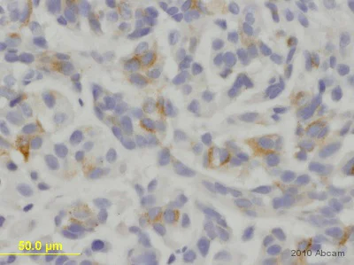Immunohistochemistry (Formalin/PFA-fixed paraffin-embedded sections) - Anti-Melanoma gp100 antibody [HMB45] (AB787)