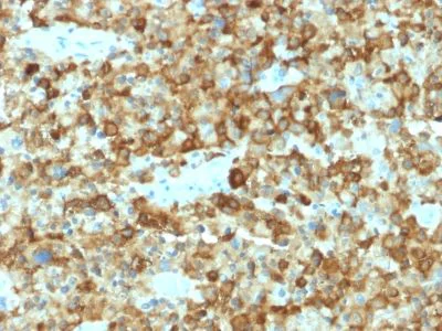 Immunohistochemistry (Formalin/PFA-fixed paraffin-embedded sections) - Anti-Melanoma gp100 antibody [PMEL/2037] (AB238047)