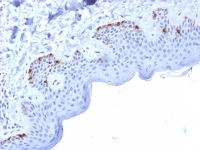 Immunohistochemistry (Formalin/PFA-fixed paraffin-embedded sections) - Anti-Melanoma gp100 antibody [PMEL/2037] (AB238047)