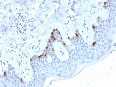 Immunohistochemistry (Formalin/PFA-fixed paraffin-embedded sections) - Anti-Melanoma gp100 antibody [PMEL/2038] - BSA and Azide free (AB237898)
