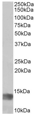 Western blot - Anti-Melanoma Inhibitory Activity antibody (AB166932)