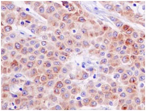 Immunohistochemistry (Formalin/PFA-fixed paraffin-embedded sections) - Anti-Melanoma Inhibitory Activity antibody [EPR15597] (AB186731)