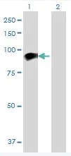 Western blot - Melanophilin overexpression 293T lysate (whole cell) (AB94249)