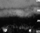Immunocytochemistry/ Immunofluorescence - Anti-Melanopsin antibody (AB19383), expandable thumbnail