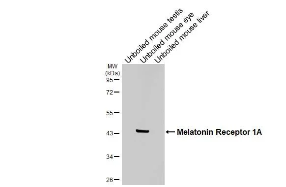 Western blot - Anti-Melatonin Receptor 1A antibody [HL4732] - BSA and Azide free (AB327588)