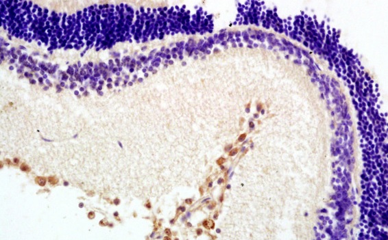 Immunohistochemistry (Formalin/PFA-fixed paraffin-embedded sections) - Anti-Melatonin Receptor 1B/MTNR1B antibody (AB203346), expandable thumbnail
