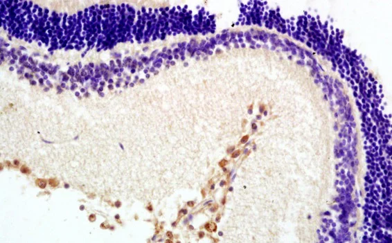 Immunohistochemistry (Formalin/PFA-fixed paraffin-embedded sections) - Anti-Melatonin Receptor 1B/MTNR1B antibody (AB203346)