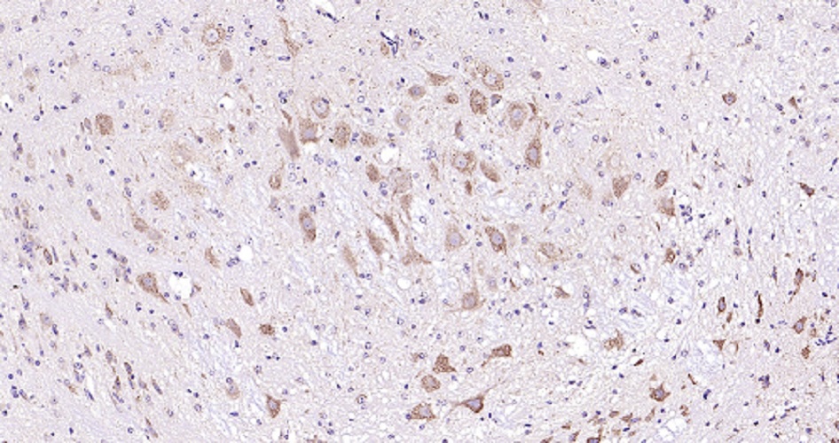 Immunohistochemistry (Formalin/PFA-fixed paraffin-embedded sections) - Anti-Melatonin Receptor 1B/MTNR1B antibody (AB203346), expandable thumbnail