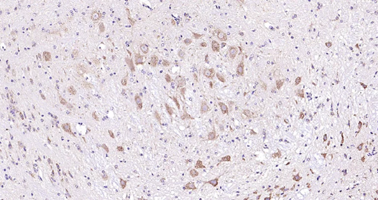Immunohistochemistry (Formalin/PFA-fixed paraffin-embedded sections) - Anti-Melatonin Receptor 1B/MTNR1B antibody (AB203346)