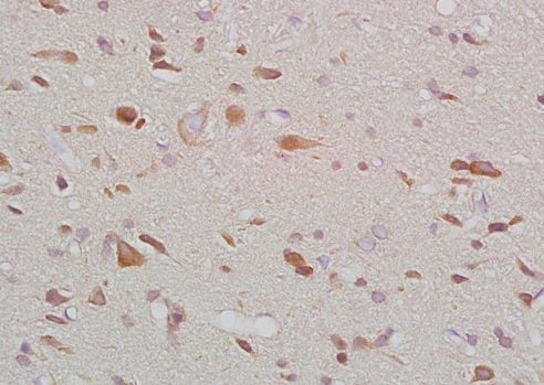 Immunohistochemistry (Formalin/PFA-fixed paraffin-embedded sections) - Anti-Melatonin Receptor 1B/MTNR1B antibody (AB203346), expandable thumbnail