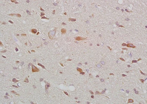 Immunohistochemistry (Formalin/PFA-fixed paraffin-embedded sections) - Anti-Melatonin Receptor 1B/MTNR1B antibody (AB203346)