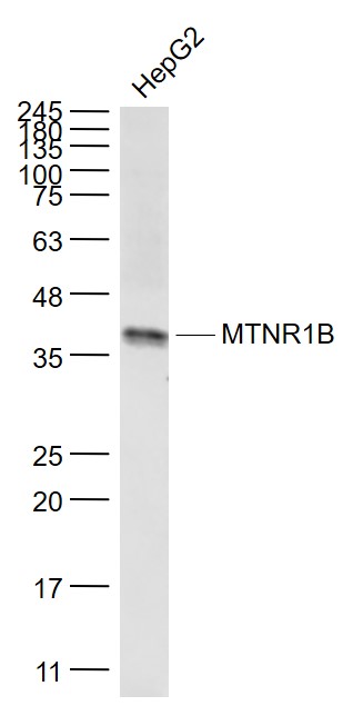 Western blot - Anti-Melatonin Receptor 1B/MTNR1B antibody (AB203346), expandable thumbnail