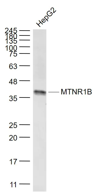 Western blot - Anti-Melatonin Receptor 1B/MTNR1B antibody (AB203346)