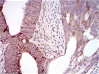 Immunohistochemistry (Formalin/PFA-fixed paraffin-embedded sections) - Anti-MELK antibody [2G2] (AB129373), expandable thumbnail