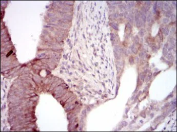 Immunohistochemistry (Formalin/PFA-fixed paraffin-embedded sections) - Anti-MELK antibody [2G2] (AB129373)