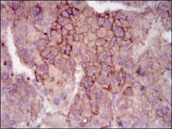 Immunohistochemistry (Formalin/PFA-fixed paraffin-embedded sections) - Anti-MELK antibody [2G2] (AB129373), expandable thumbnail