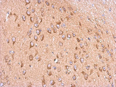 Immunohistochemistry (Formalin/PFA-fixed paraffin-embedded sections) - Anti-Membralin antibody (AB155590), expandable thumbnail
