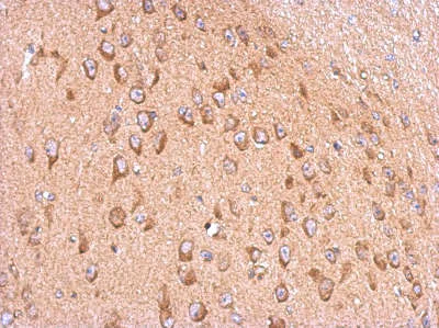 Immunohistochemistry (Formalin/PFA-fixed paraffin-embedded sections) - Anti-Membralin antibody (AB155590)