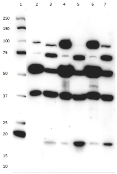 Western blot - Membrane Fraction WB Cocktail (AB140365), expandable thumbnail