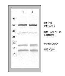 Western blot - Membrane Integrity WB Antibody Cocktail (AB110414), expandable thumbnail
