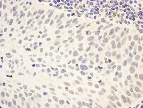 Immunohistochemistry (Formalin/PFA-fixed paraffin-embedded sections) - Anti-Menin antibody (AB2605)