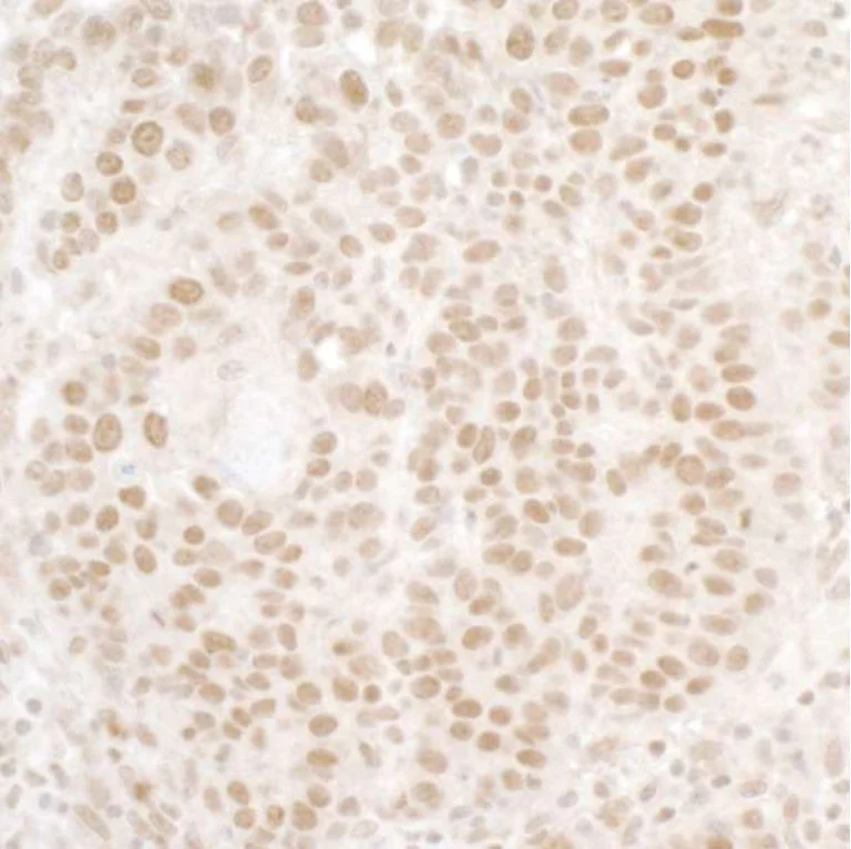 Anti-Menin antibody. Rabbit polyclonal (ab2605) | Abcam