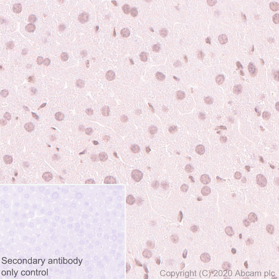 Immunohistochemistry (Formalin/PFA-fixed paraffin-embedded sections) - Anti-Menin antibody [EPR3986] (AB92443), expandable thumbnail