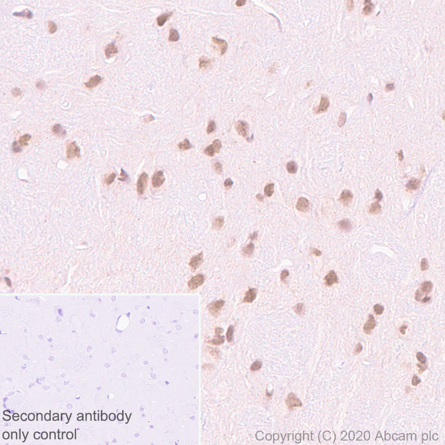 Immunohistochemistry (Formalin/PFA-fixed paraffin-embedded sections) - Anti-Menin antibody [EPR3986] (AB92443), expandable thumbnail