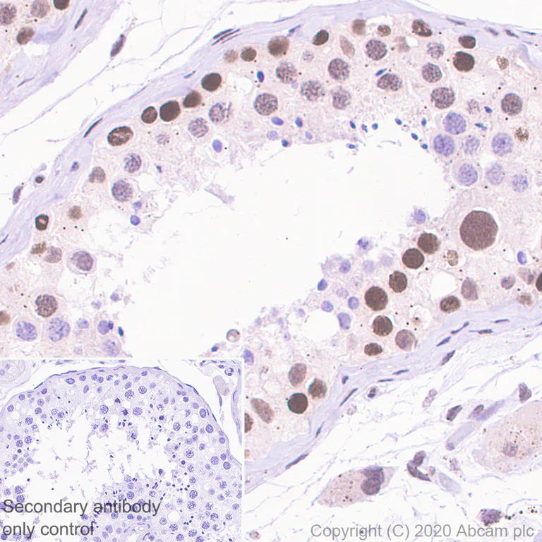Immunohistochemistry (Formalin/PFA-fixed paraffin-embedded sections) - Anti-Menin antibody [EPR3986] (AB92443)
