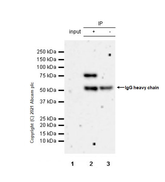 Immunoprecipitation - Anti-Menin antibody [EPR3986] (AB92443), expandable thumbnail