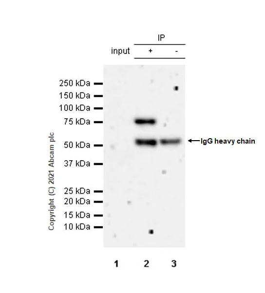 Immunoprecipitation - Anti-Menin antibody [EPR3986] (AB92443)