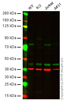 Western blot - Anti-Menin antibody [EPR3986] (AB92443)