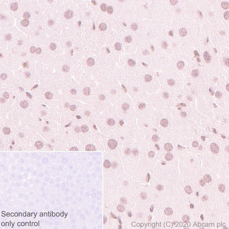Immunohistochemistry (Formalin/PFA-fixed paraffin-embedded sections) - Anti-Menin antibody [EPR3986] - BSA and Azide free (AB239910)