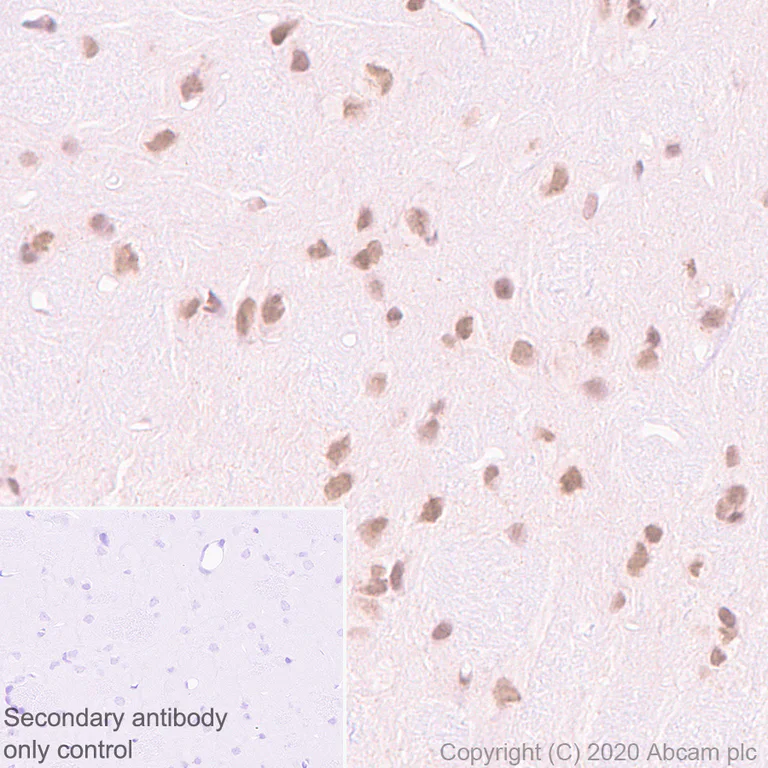Immunohistochemistry (Formalin/PFA-fixed paraffin-embedded sections) - Anti-Menin antibody [EPR3986] - BSA and Azide free (AB239910)