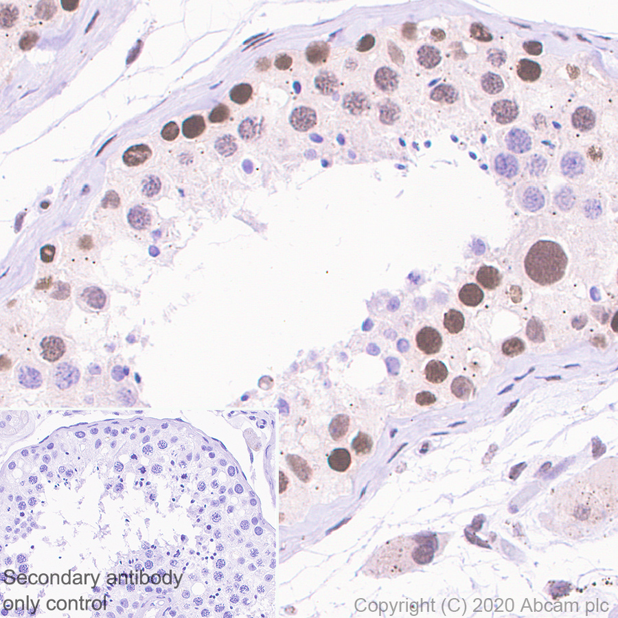 Immunohistochemistry (Formalin/PFA-fixed paraffin-embedded sections) - Anti-Menin antibody [EPR3986] - BSA and Azide free (AB239910)