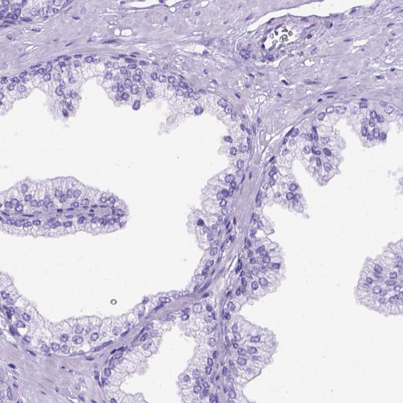 Immunohistochemistry (Formalin/PFA-fixed paraffin-embedded sections) - Anti-MEOX 2 antibody (AB262916), expandable thumbnail