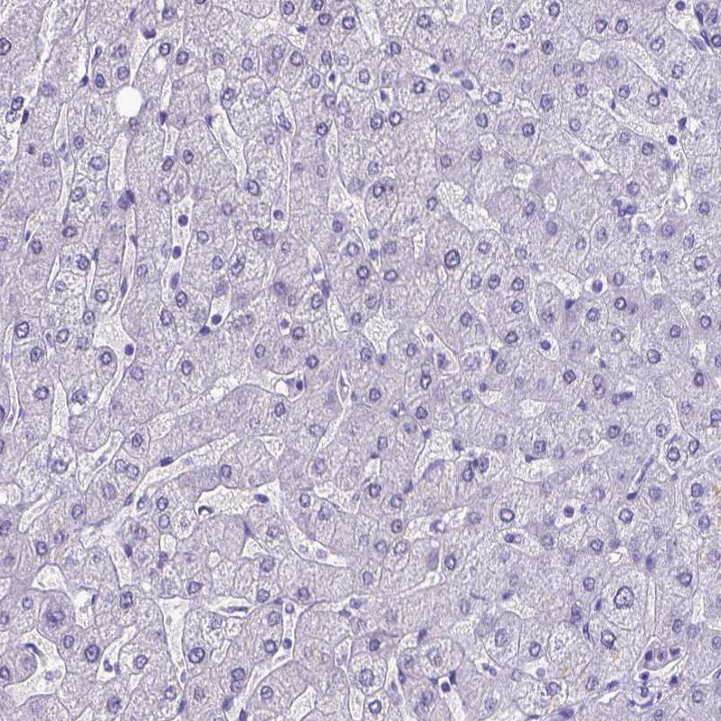 Immunohistochemistry (Formalin/PFA-fixed paraffin-embedded sections) - Anti-MEOX 2 antibody (AB262916), expandable thumbnail