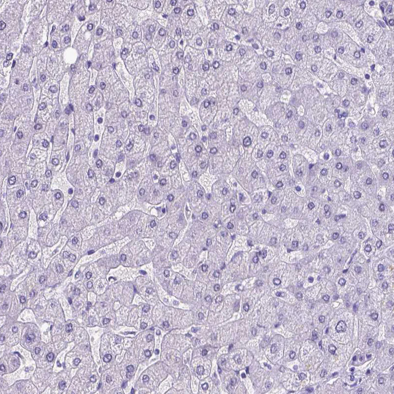 Immunohistochemistry (Formalin/PFA-fixed paraffin-embedded sections) - Anti-MEOX 2 antibody (AB262916)