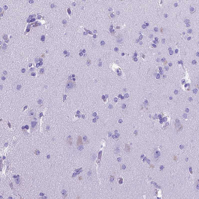 Immunohistochemistry (Formalin/PFA-fixed paraffin-embedded sections) - Anti-MEOX 2 antibody (AB262916), expandable thumbnail