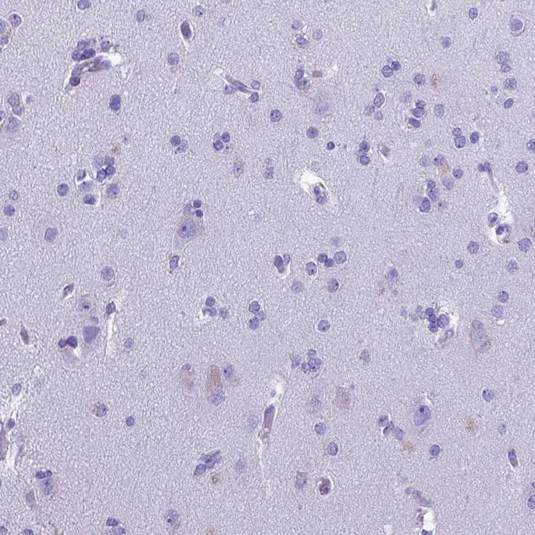 Immunohistochemistry (Formalin/PFA-fixed paraffin-embedded sections) - Anti-MEOX 2 antibody (AB262916)