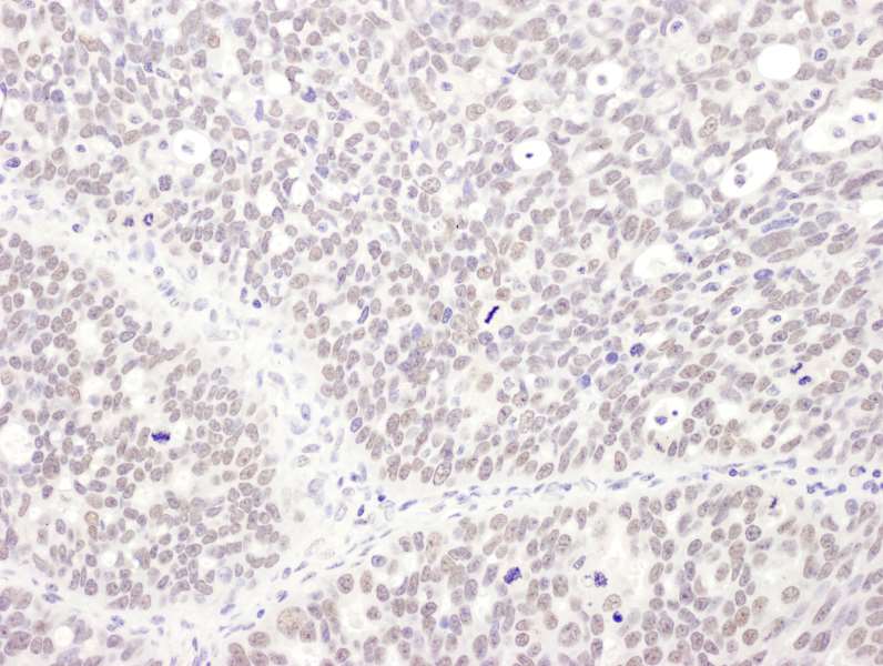 Immunohistochemistry (Formalin/PFA-fixed paraffin-embedded sections) - Anti-MEPCE antibody - C-terminal (AB185991)